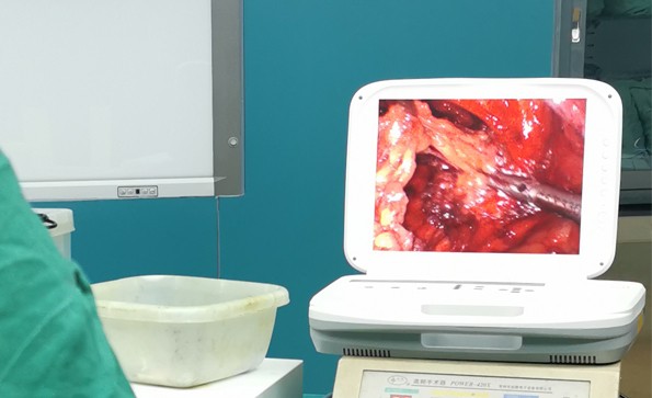 【腹腔鏡篇】腹腔鏡疝氣手術，您知道嗎？